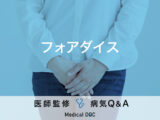 「フォアダイス」を発症すると現れる症状・原因はご存知ですか？医師が監修！
