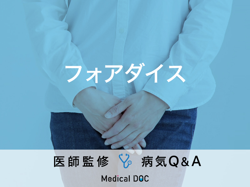 フォアダイス斑点はどのように診断されますか?