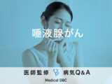 「唾液腺がん」を疑う初期症状・原因・生存率はご存知ですか？医師が監修！