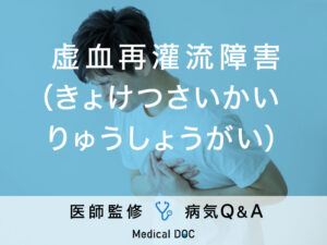 「虚血再灌流障害」を発症するメカニズム・症状はご存知ですか？医師が監修！