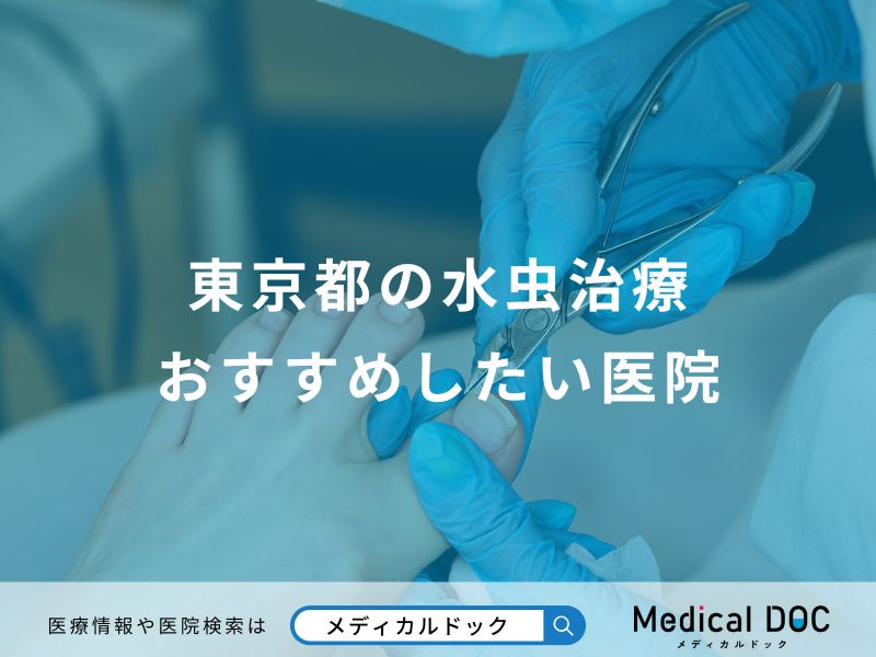 東京都の水虫治療おすすめしたい医院