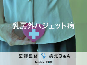 「乳房外パジェット病」を疑う初期症状・生存率はご存知ですか？医師が監修！