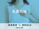 「乳房肉腫」の症状・原因・乳がんとの違いはご存知ですか？医師が監修！
