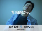 「腎細胞がん」を疑う初期症状・原因はご存知ですか？医師が監修！