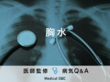 「胸水（胸水貯留）」を発症すると現れる症状・予防法はご存知ですか？医師が監修！