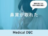 「鼻茸が取れる」のは「蓄膿症」や「副鼻腔炎」が原因？医師が徹底解説