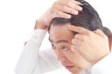 「AGAの初期症状」はご存知ですか？原因・対策についても解説！医師が監修！