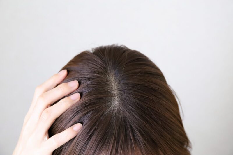 フケの原因と対処法を知ろう