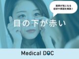「目の下が赤い」原因・対処法はご存知ですか？医師が徹底解説！