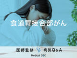 「食道胃接合部がん」の症状や原因はご存知ですか？ステージについても解説！