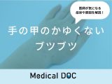 「手の甲のかゆくないブツブツ」ができる原因はご存知ですか？医師が徹底解説！