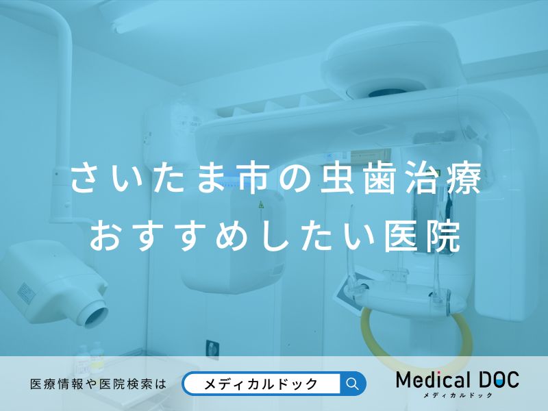 さいたま市の虫歯治療 おすすめしたい医院