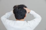 「AGAが遺伝」するの？予防法も併せて解説！【医師監修】