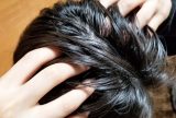 「薄毛を自分で治す」のは可能？薄毛の原因・セルフケアによる対策について解説！