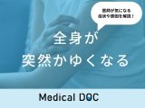 「全身が突然かゆくなる」原因・考えられる病気はご存知ですか？医師が徹底解説！