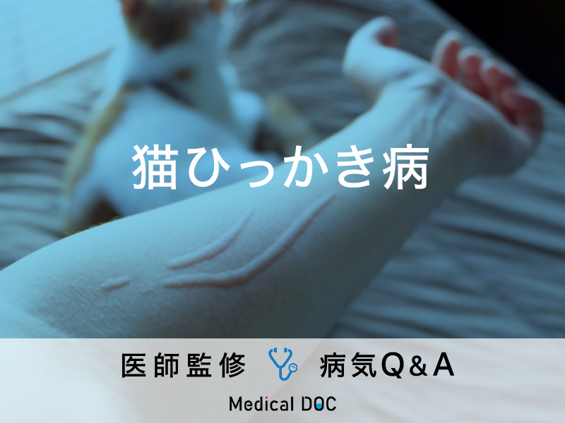 疥癬の見分け方