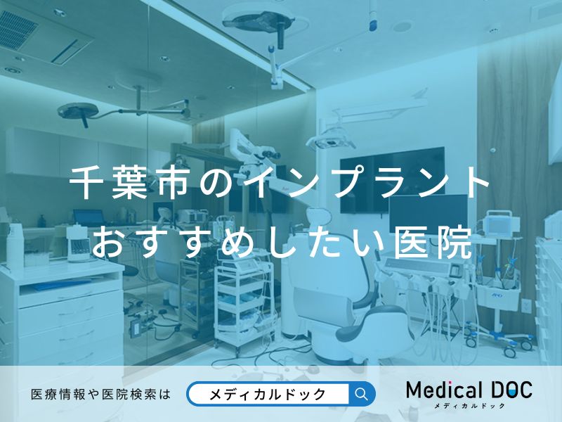 千葉市のインプラント医院 おすすめしたい医院