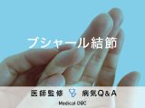 「ブシャール結節」を発症しやすい年齢層や性別はご存知ですか？【医師監修】