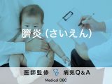 「臍炎」という新生児に発症するおへそが炎症を起こす病気について解説！