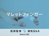 「マレットフィンガー」の痛みの特徴・治療期間はご存知ですか？【医師監修】