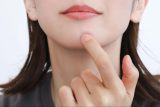ニキビ治療のおすすめの方法は？ニキビの原因・治療法・治療薬をご紹介します