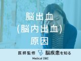 「脳出血（脳内出血）の原因」はご存知ですか？予防法も医師が徹底解説！