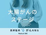 「大腸がんのステージ」別の症状・余命・生存率はご存知ですか？医師が解説！