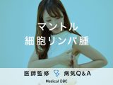 「マントル細胞リンパ腫」の症状・原因・生存率はご存知ですか？医師が監修！