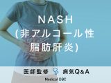 「NASH(非アルコール性脂肪肝炎)」はアルコールの摂取とは関係なく発症する？