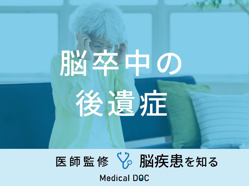 後部循環脳卒中の症状