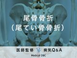 「尾骨骨折」の原因や症状を解説！長時間のデスクワークも骨折の原因に？