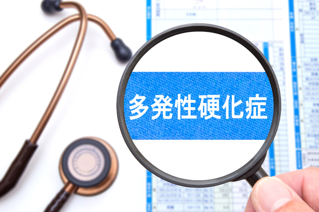 MSによる痛みはどのように治療されますか?