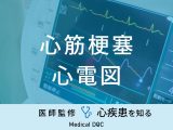 「心筋梗塞を疑う心電図」の波形や経過はご存知ですか？部位診断でわかることも解説！