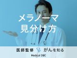 「メラノーマの見分け方」はご存知ですか？発症しないために気をつけることも解説！