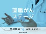「直腸がんのステージ別・生存率」はご存知ですか？症状や大腸がんとの違いも解説！