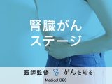 「腎臓がんのステージ」はご存知ですか？ステージ別の治療法も解説！【医師監修】