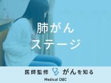 「肺がんのステージ」別の余命・生存率・治療法はご存知ですか？医師が解説！