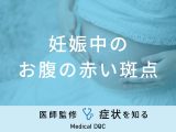 「妊娠中にお腹に赤い斑点」ができる原因はご存知ですか？医師が徹底解説！