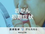「舌がんの前兆となる初期症状」はご存知ですか？原因・検査法も解説！【医師監修】