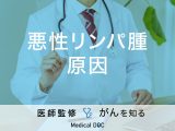 「悪性リンパ腫の原因」はご存知ですか？症状や治療法も解説！【医師監修】