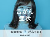 「舌がんの代表的な症状」はご存知ですか？検査法・治療法も解説！【医師監修】