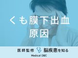 「くも膜下出血の原因」となる可能性の高い食べ物はご存知ですか？医師が解説！