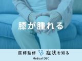 「膝が腫れる」のは「痛風」や「関節リウマチ」が原因？医師が徹底解説！