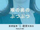 「喉の奥にぶつぶつ」ができる原因はご存知ですか？医師が対処法も徹底解説！