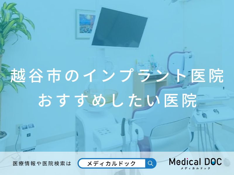 越谷市のインプラント医院おすすめしたい医院