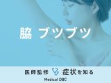 「脇にブツブツ」ができる原因・対処法はご存知ですか？医師が徹底解説！