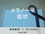 「メラノーマの症状」はご存知ですか？見分け方も解説！【医師監修】