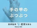 「手の甲にぶつぶつ」ができる原因はご存知ですか？対処法も医師が徹底解説！