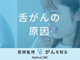 「舌がんの原因」はご存知ですか？治療法や早期発見法も解説！【医師監修】