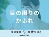 「目の周りのかぶれ」の原因はご存知ですか？考えられる病気も医師が徹底解説！